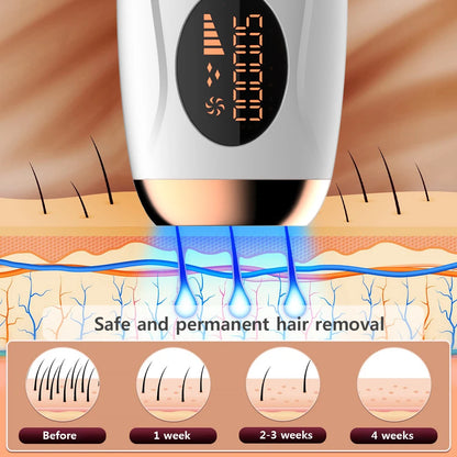 IPL Laser Epilator Permanent Hair Remover