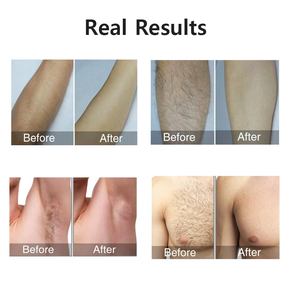 IPL Laser Epilator Permanent Hair Remover
