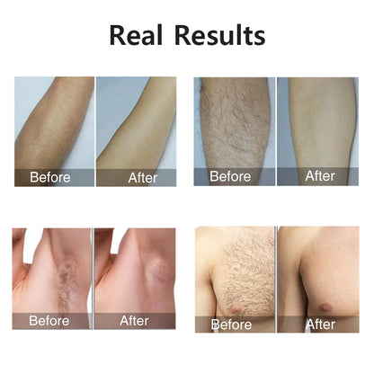 IPL Laser Epilator Permanent Hair Remover